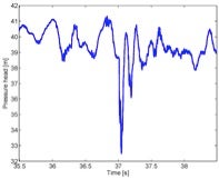 Water Distribution Network Detection and Localization Sets